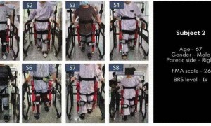 中国智能外骨骼机器人迎来新突破，下肢偏瘫患者福音